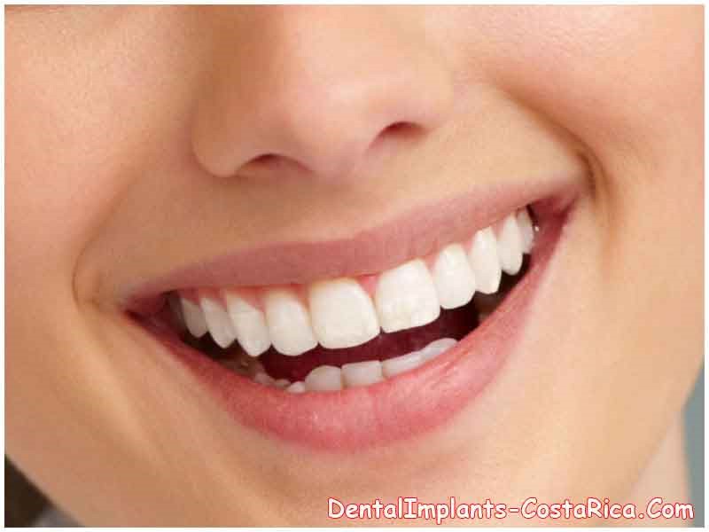Zirconia Dentures Moffit ND 58560